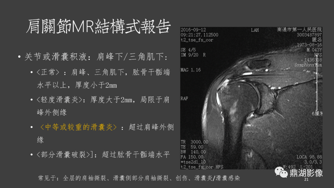 肩关节mri的结构式评估