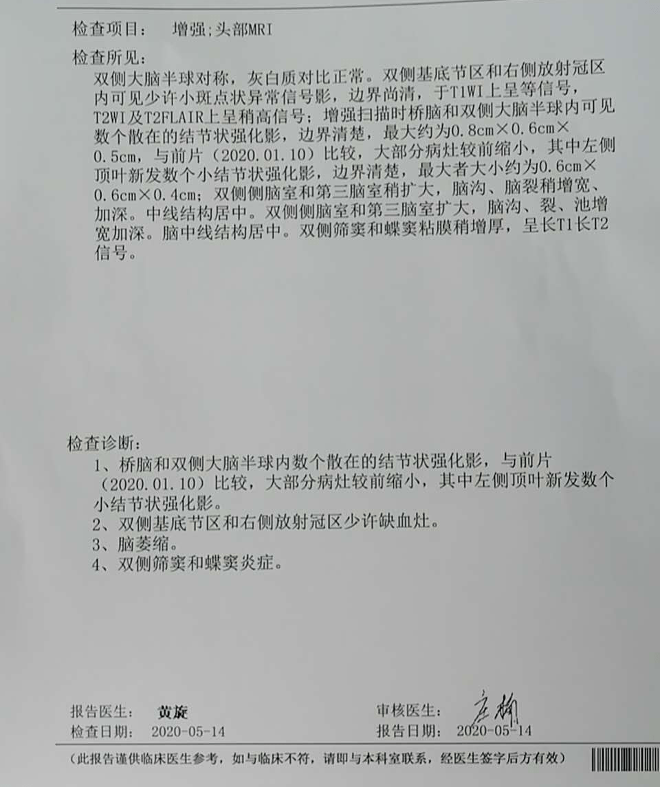 2020年10月,头部症状加重明显,每20分钟出现一次,体感很差,人无精神