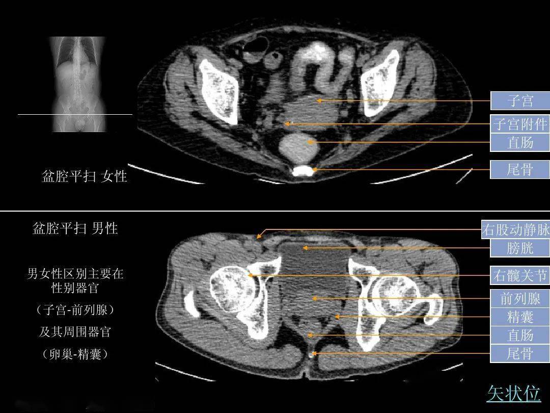 腹部ct入门解剖图谱收藏版