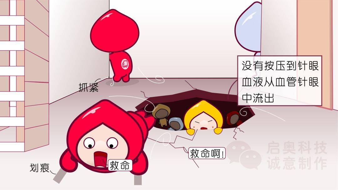 【献血科普】为什么献完血手臂上有淤青？_针眼