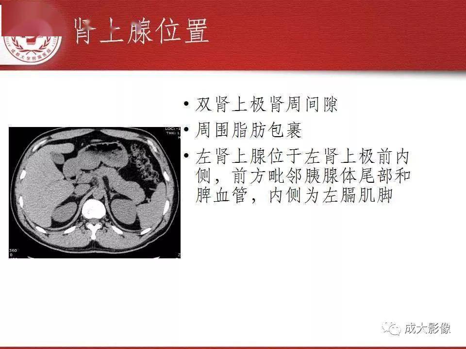 常见肾上腺疾病影像诊断