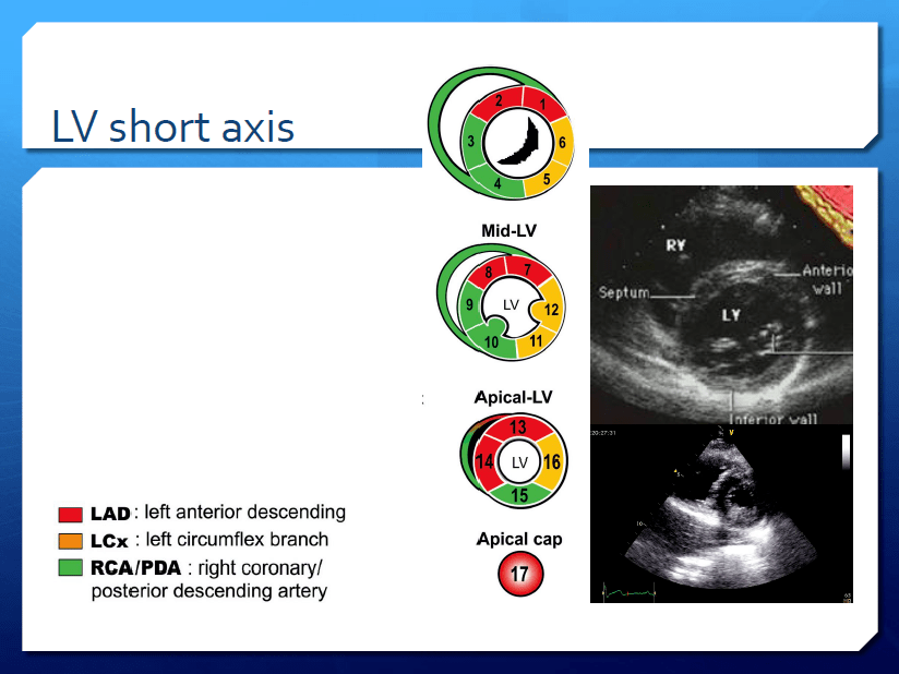 临床指南与知识更新心脏超声与心肌缺血