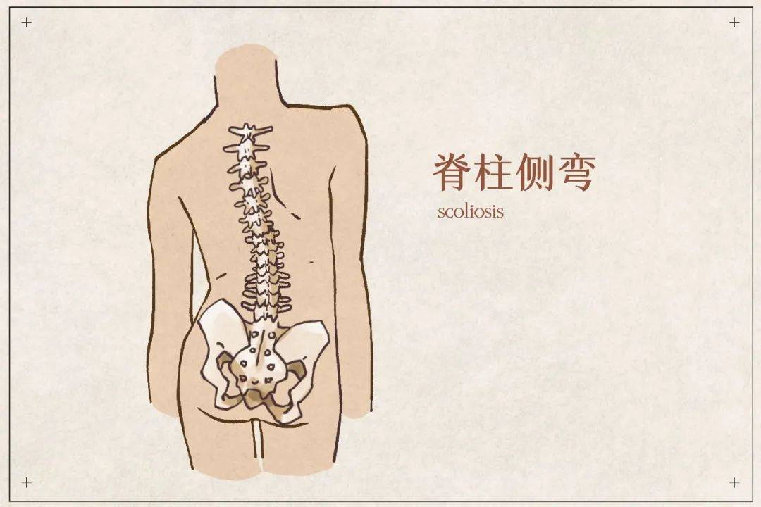 你还"坐"得住吗?_骨盆