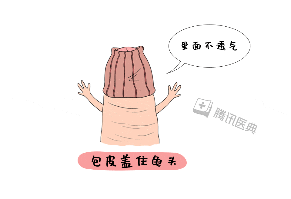 割包皮手术后多久能上战场你关心的问题都在这里了
