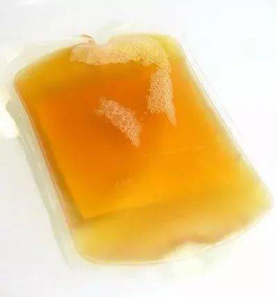 我在医院见到有人输黄色的血液,是怎么回事?_血浆