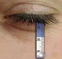 口干眼干原来是这个病