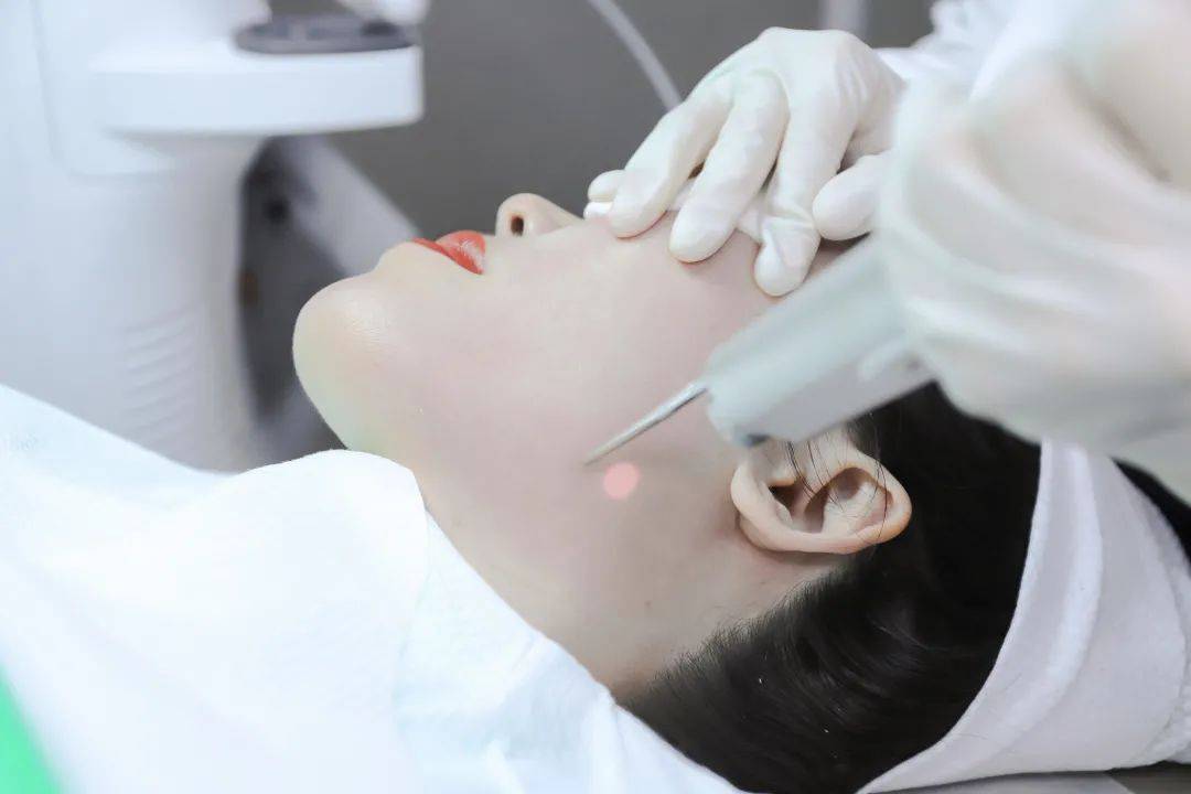 素素探店19999元次的fotona4dpro到底香不香