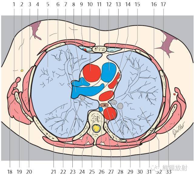 收藏!精美详细的胸部ct断层解剖图(双语)
