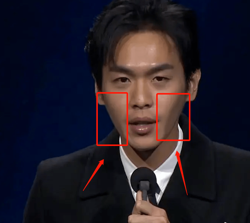 张若昀因额头正方形反光登热搜,脸颊凹陷气色不佳,令人颇为担忧