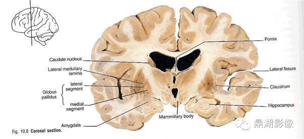 前额叶杏仁核海马体图片