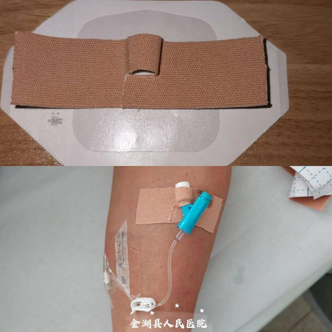 巧用3m宜拉胶带制作导管固定贴(安心贴)