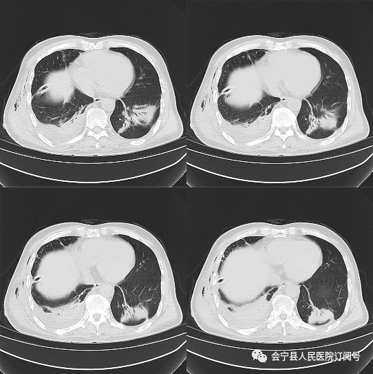 会宁县医院6名医师简历