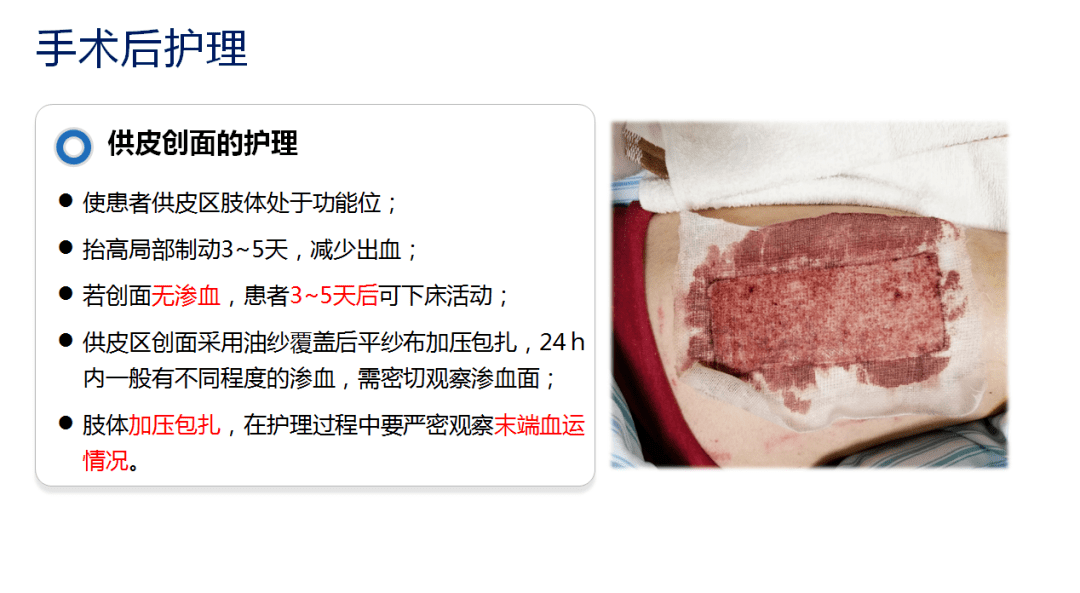 【周四讲堂】乳腺癌患者植皮术后护理
