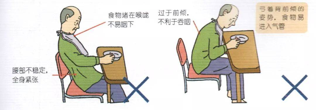 半护理,全护理长者床上进食的照护喂食的方法:无法保持稳定的坐姿时