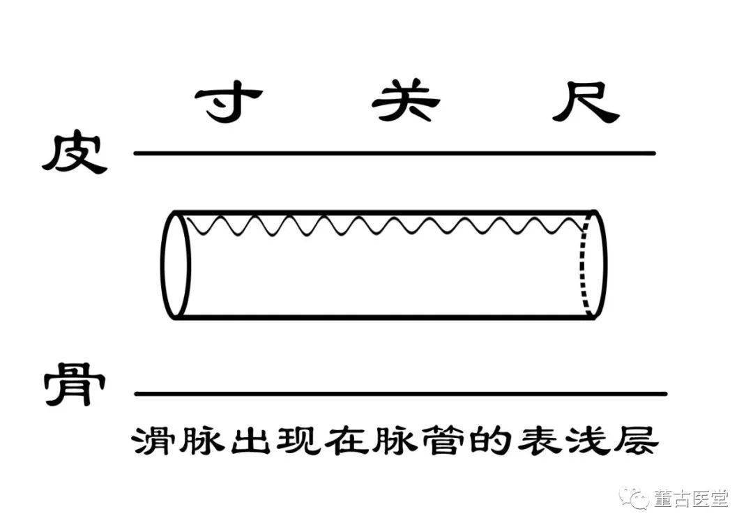 《图解脉诊》网络课问题答疑二 如何感受滑脉