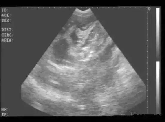 b超检查母猪妊娠详细图文教你识别