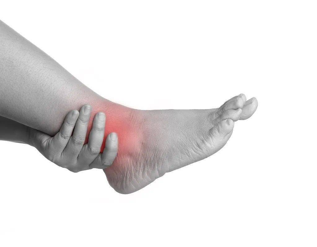 卫生社团踝关节疼痛别大意警惕踝关节撞击综合征