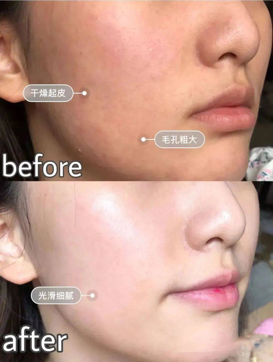 今天兰蔻粉水的价格让你一次屯个够