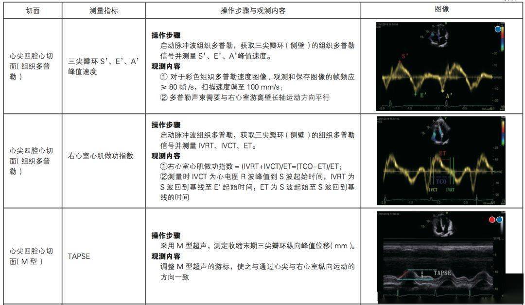 超声心动图管理团队需有医师(心脏专科医师为主),技师,护士等,按照