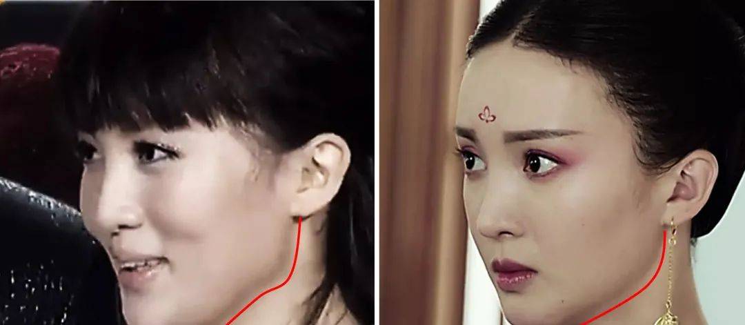 再来看看刚整那会儿的长相,说鼻子高耸入云一点都不夸张,整张脸也很僵