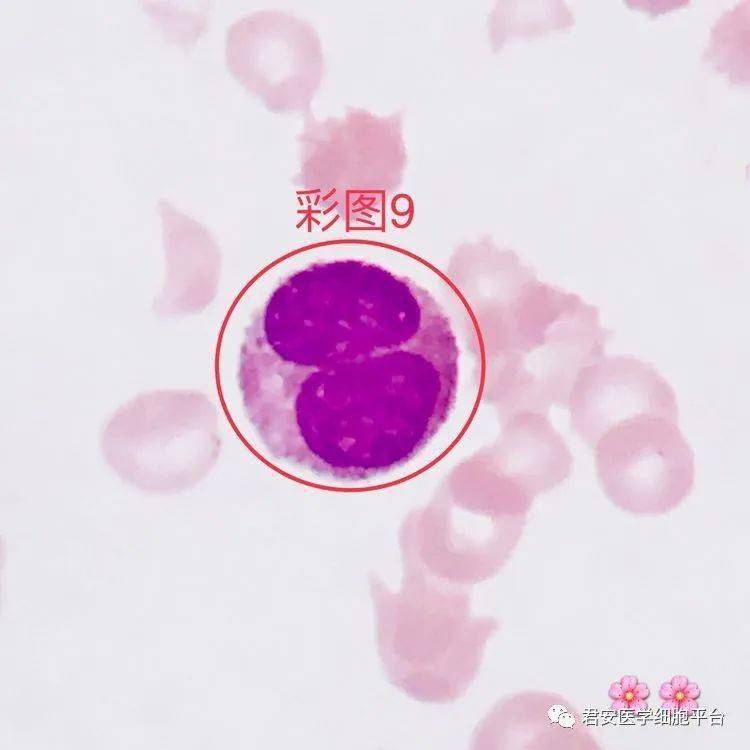 【朝华夕秀】看图专栏(第12期)_粒细胞