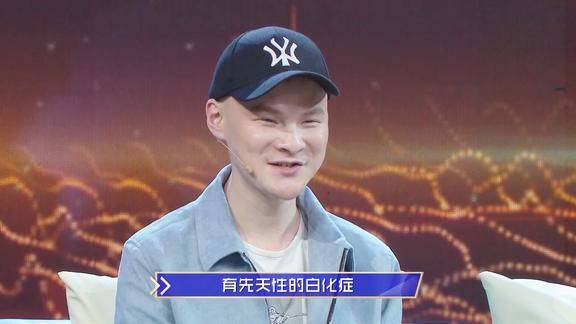 白化病歌手黄强分享追梦路上的酸甜苦辣