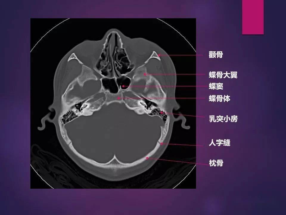 頭顱正常影像解剖軀幹骨骼正常影像解剖四肢骨骼正常影像解剖