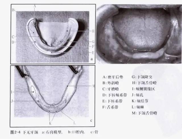 正常颊系带的位置图片图片