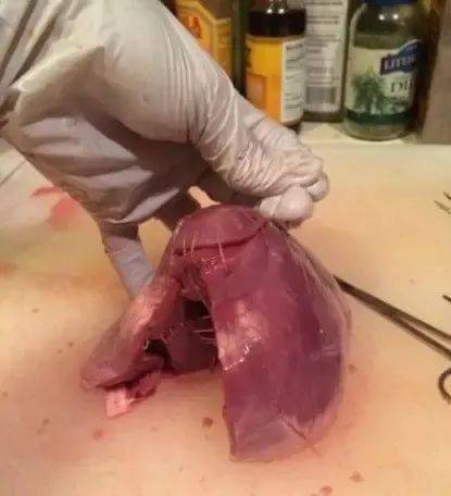 一个学医女生扎了男友10多刀刀刀避开要害