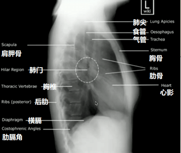 胸片部位图解图片