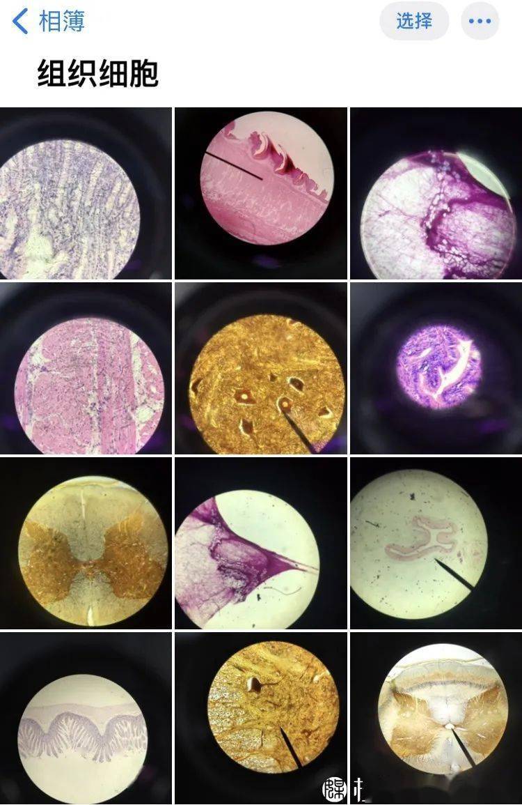 最獨特的存在是醫學生相冊裡猶如一幅幅精緻的藝術品各種組織切片小腸