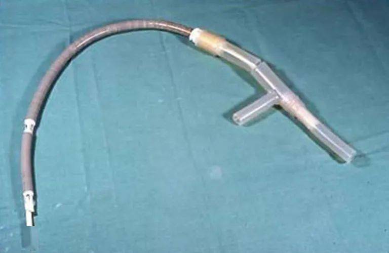 经皮置管：适应证、操作技术和并发症 |《ECMO——成人的体外生命支持》文章精选_导管
