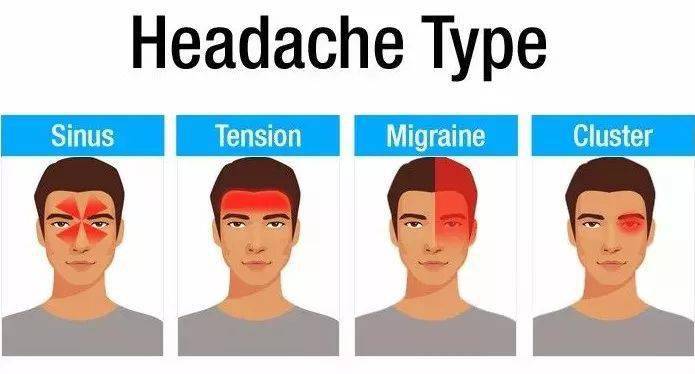 丛集性头痛是所有头痛中比较严重的一种,属于血管性头痛之一.