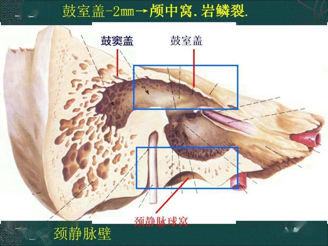 耳解剖及常见疾病影像表现