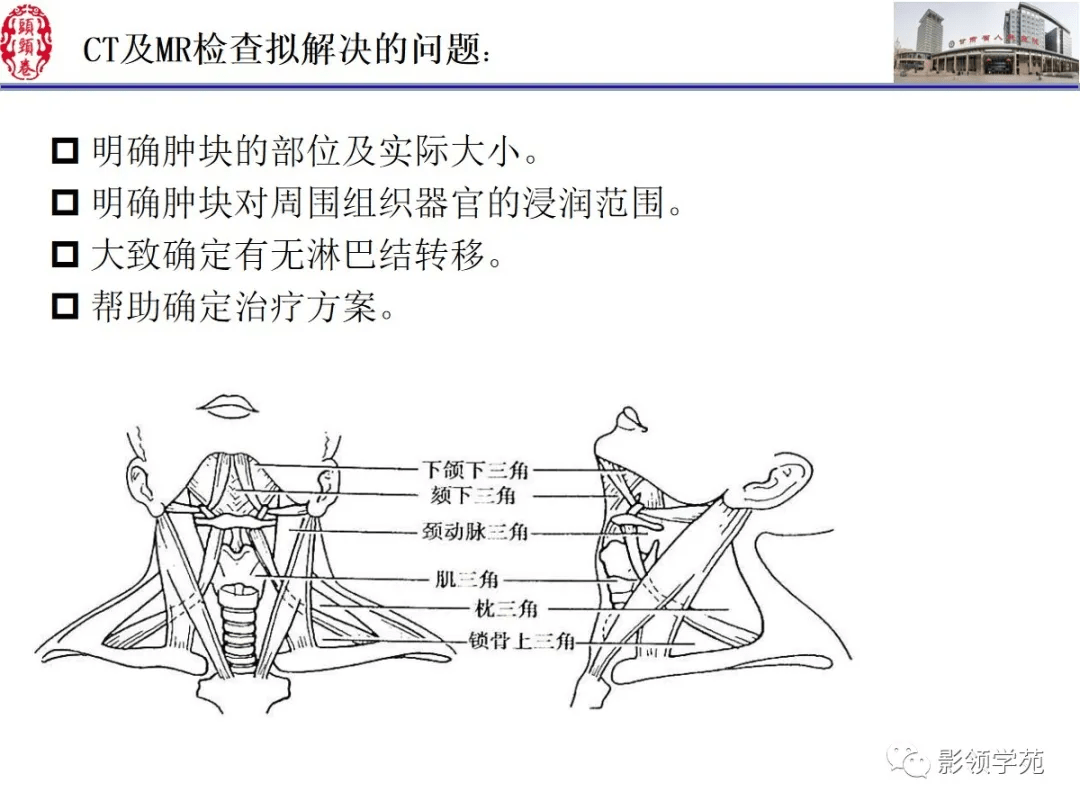 舌下腺袋形缝合术图解图片