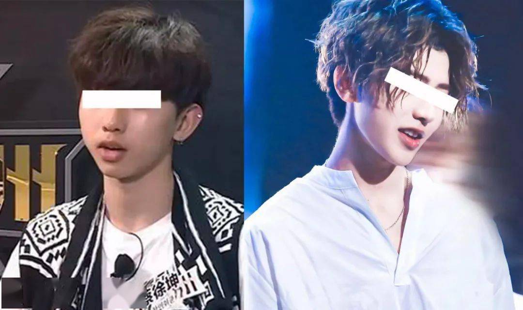 男性整容5大爆单品项2021新风口