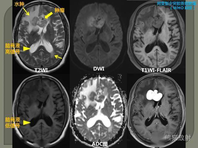 如何简单理解认识mri图像