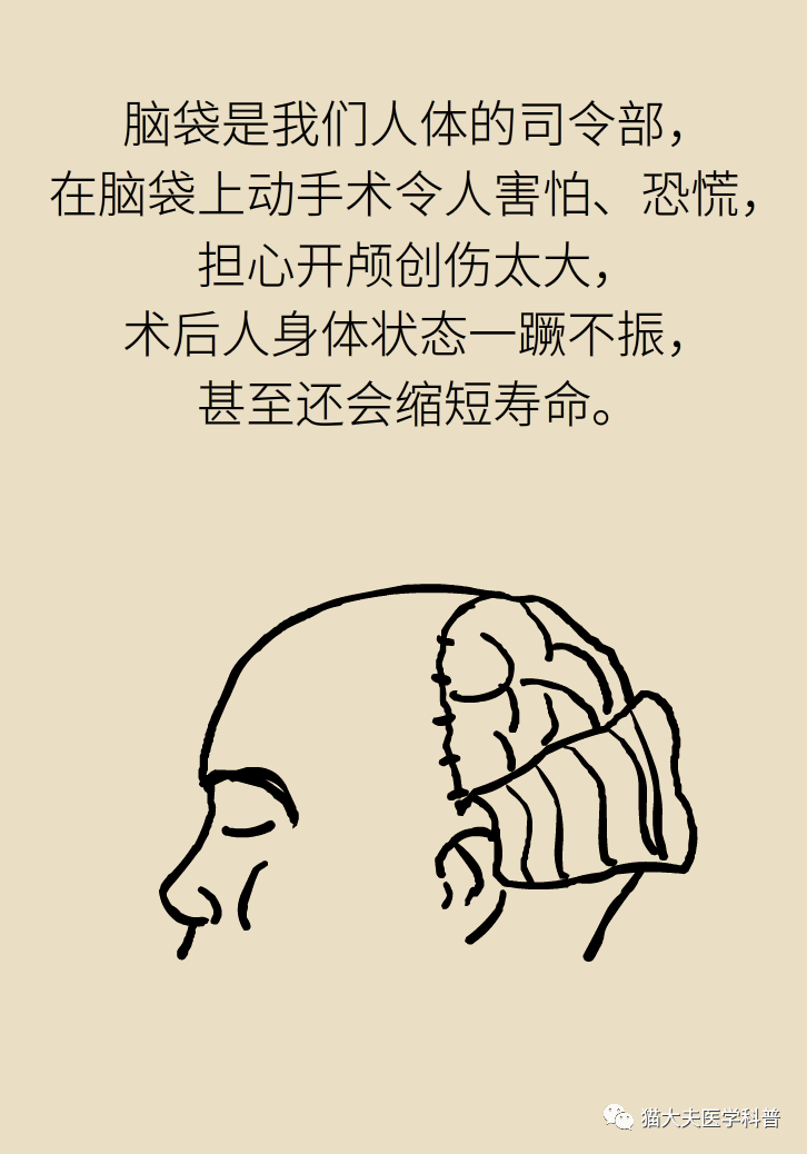 开颅手术就是打开人的天灵盖我怀疑你是个古代人