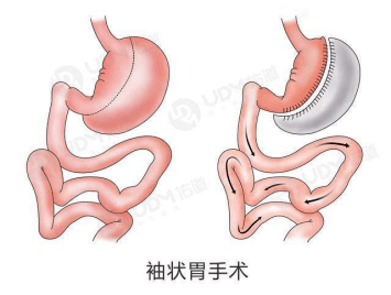 减肥代谢科 66ec9c6eb7914477b60149aac87673cb.png