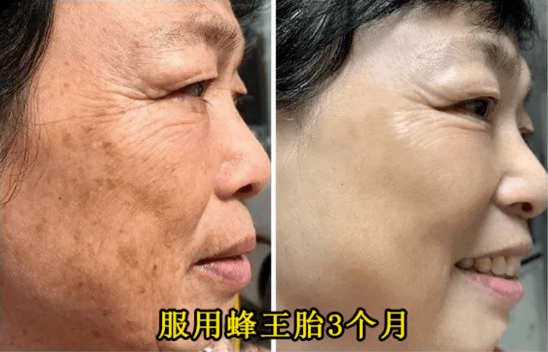 8050dde10a69444192fd93dd4ede979f.png