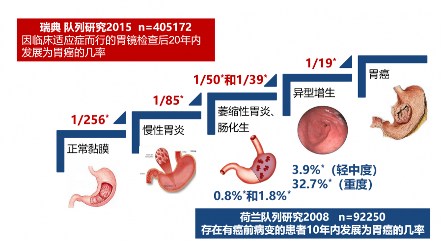 腸化,是腸上皮化生的簡稱,顧名思義,就是胃黏膜的一部分細胞被腸細胞