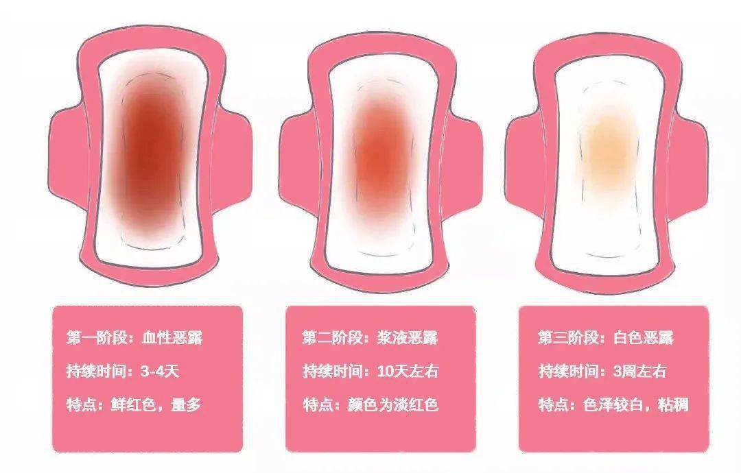 【女性健康】子宫复旧,产后恢复的头等大事儿!稍不注意危害大!