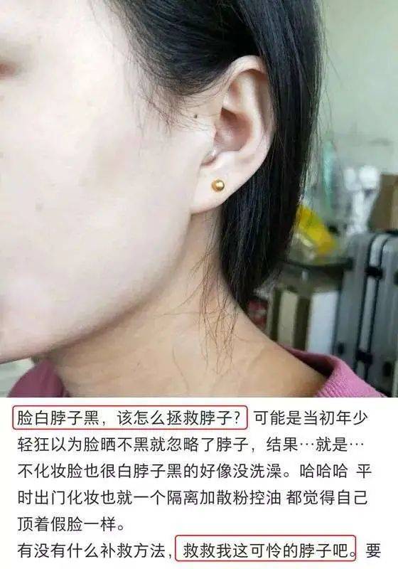 怎样能减少颈纹 23f222ac656e4728a4bc81b1eb6eabc0.jpeg