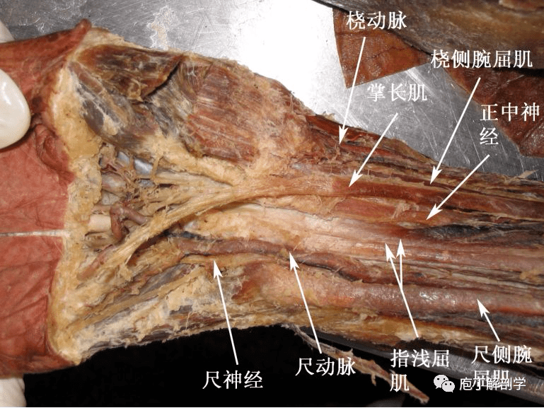 疼痛科专业人体解剖详解