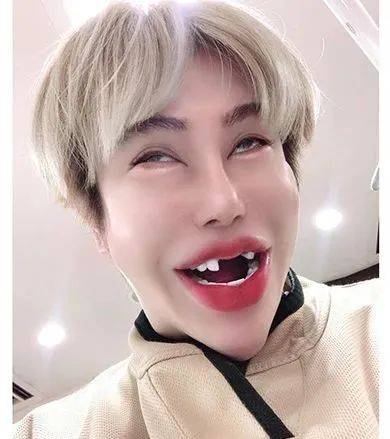 日本一帅气小伙花1亿做全身整容最后终于整成了悲伤蛙这是有多想不开