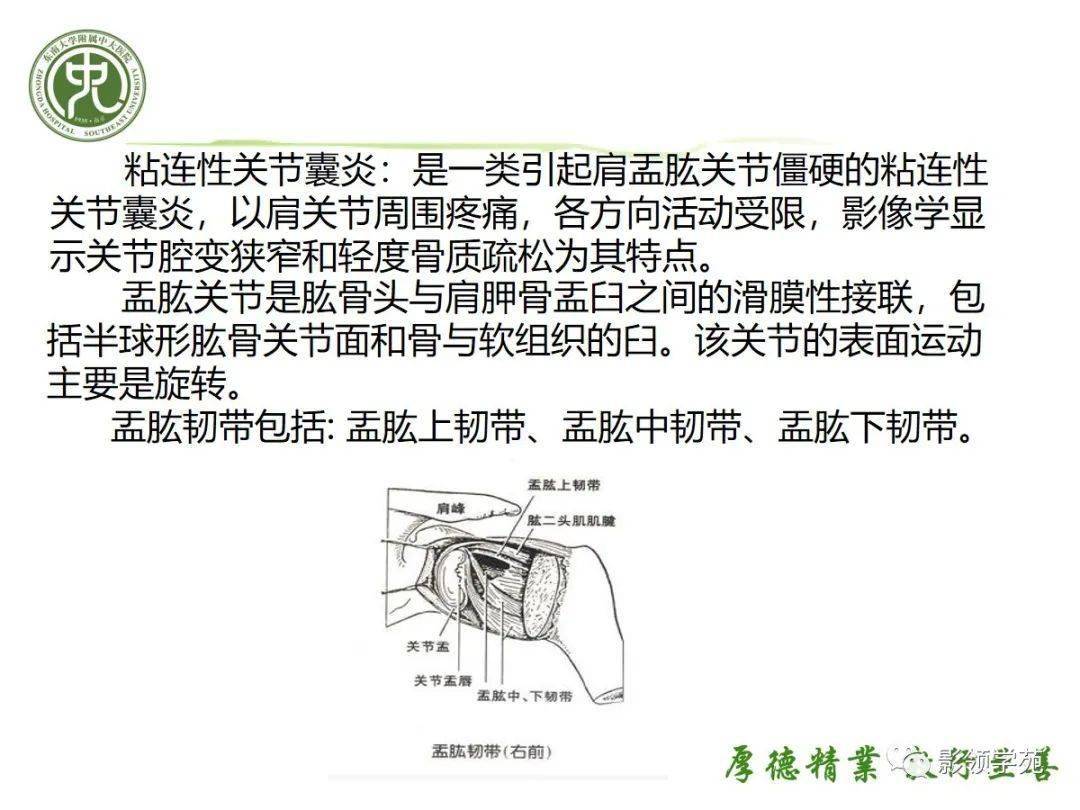 粘连性肩关节囊炎