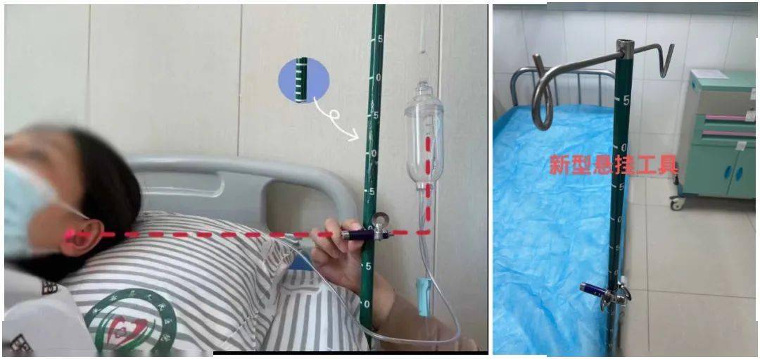 脑室引流管作为神经外科的专科引流管,对悬挂高度要求高,患者的头部