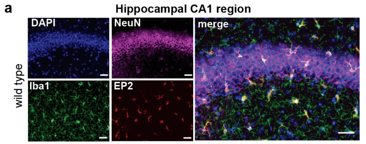 老年小鼠海马依赖的空间记忆学习出现障碍,在敲除ep2这种障碍不复存在