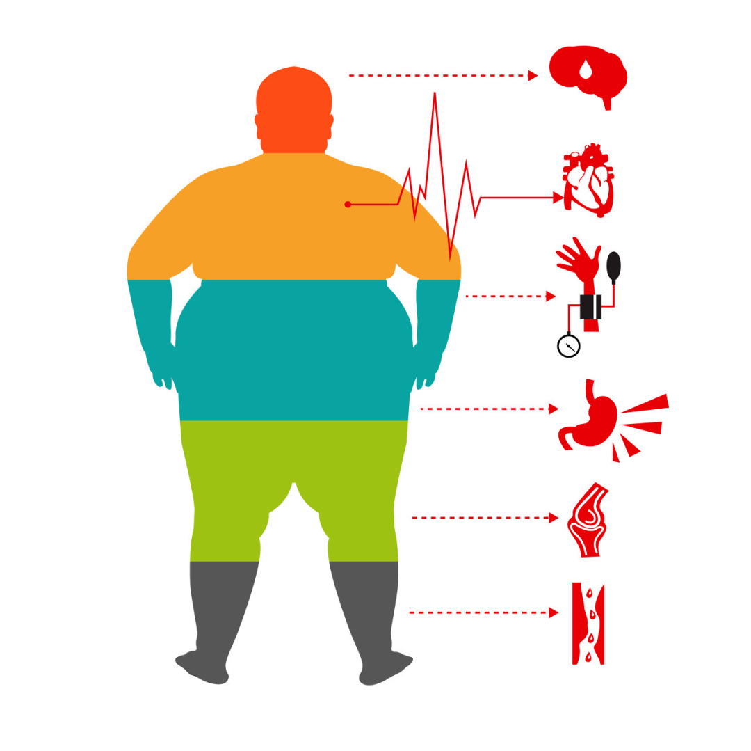 526斤超级肥胖患者成功实施减重手术 预计1年内减重250-300斤-直播吧zhibo8.cc
