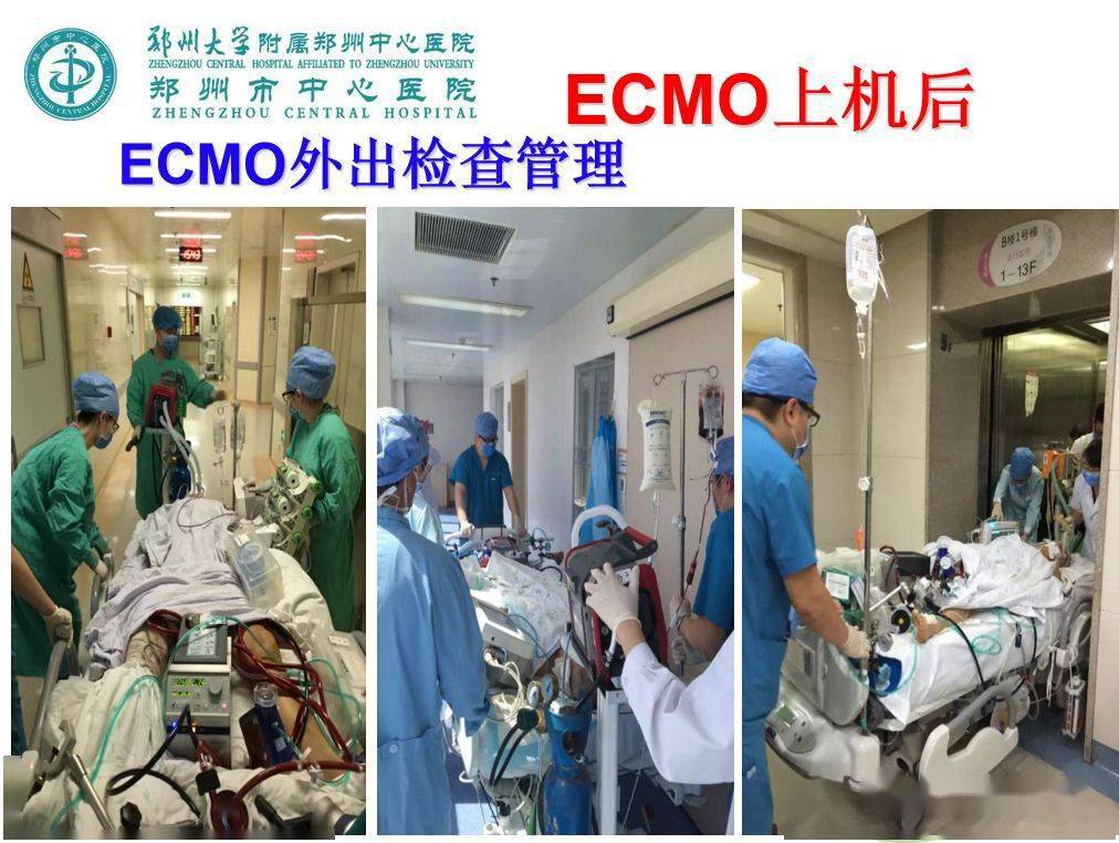 ecmo患者如何护理这几点重点提示你一定要看看